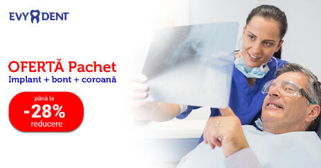 Implant dentar Oferta 28% implant dentar la Urziceni
